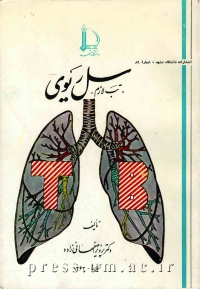 سل ریوی: تب لازم